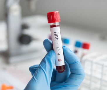 blood vial in lab labeled HIV