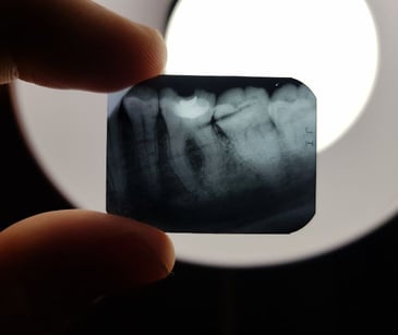How does HIPAA apply to dental research?