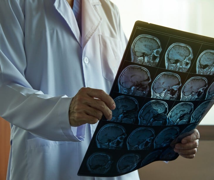 Image of someone looking at a brain scan. 