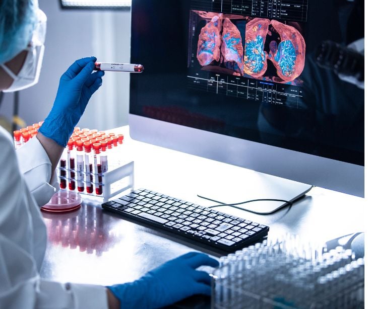 provider in front of laptop with blood vile lungs on screen