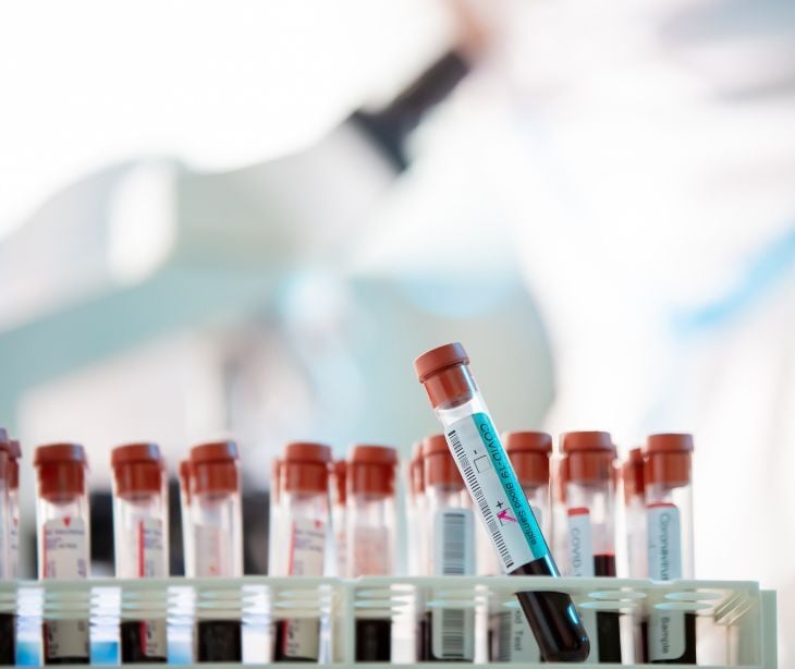 Image of lab equipment. 