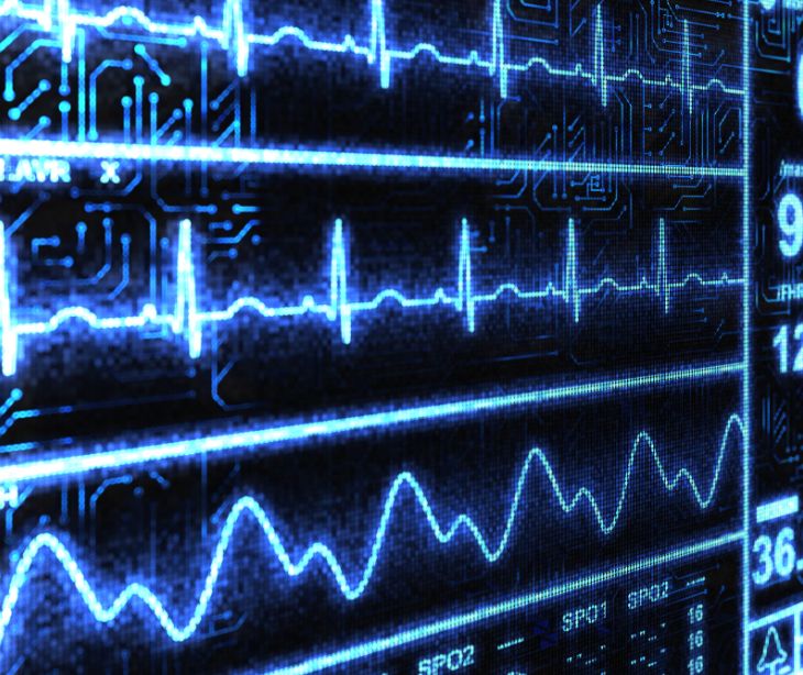 Enhancing cardiac rehabilitation monitoring with HIPAA compliant email