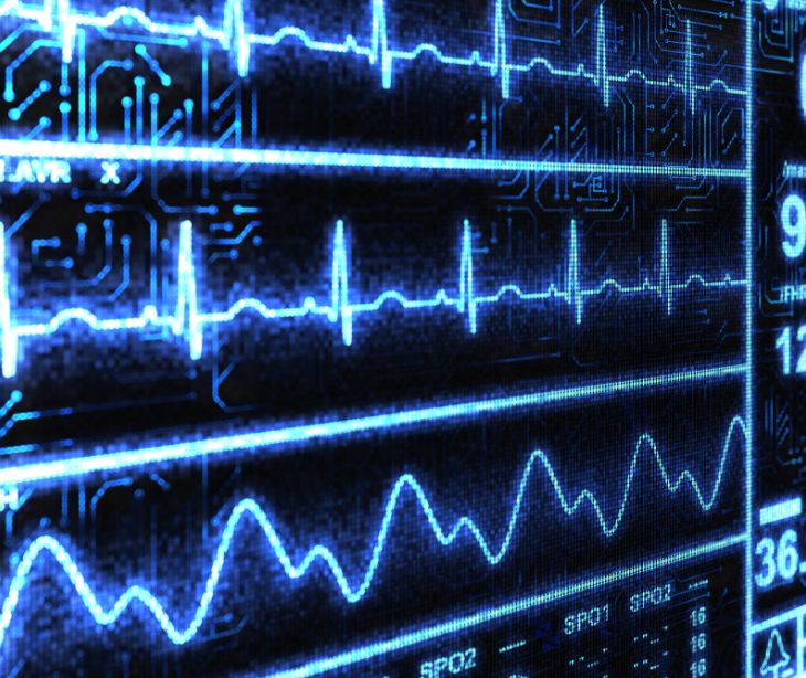 cardiac monitoring device