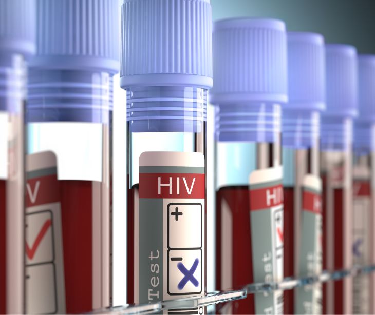 HIV blood vials