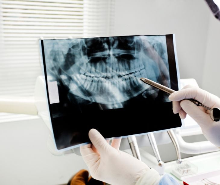 dental record
